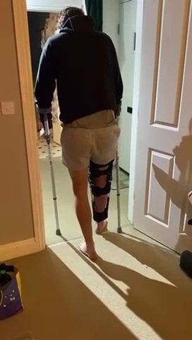 Video grab of Regan Hitch walking on crutches. Photo released November 24 2024. Best friend sets up a GoFundMe for man who torn three out of the four ligaments in his knee.Olly Dickson, 28, was horrified on the 13 the November as he witnessed two of his friends collide at a training match for Alton Phoenix FC.Alton Phoenix are a step five football team located in Alton, Hampshire. Regan Hitch, 28, recently joined the team with a bag of experience at Semi- pro levels.Unfortunately, it looks as though his footballing career is sadly coming to an end. 'Reggie' completely tore three of the four major ligaments in his knee. His ACL, MCL, and cruciate, and only one ligament was left holding it all together.
